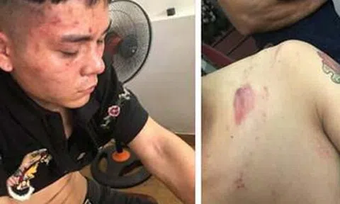 Thực hư chuyện công an phường bị tố đánh người ở Hải Phòng